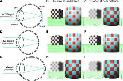 Inclusivity in stereoscopic XR: Human vision first